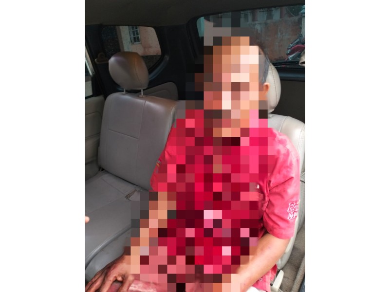 Ditodong Penumpang Pakai Pisau, Driver Taksi Online Luka-luka Berlumuran Darah