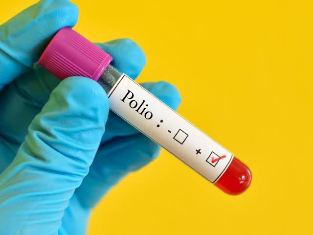 Diskes Klaim Pekanbaru Nihil Kasus Polio